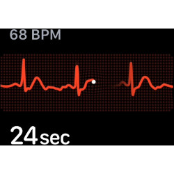 Aplicatia ECG